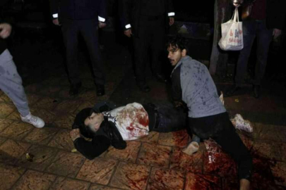 Köpek gezdiren kişi tarafından bıçaklanan genç ağır yaralandı