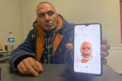 Afrika sineğinin ısırması sonucu yakalandığı "şark çıbanı"ndan 2 aylık tedaviyle kurtuldu