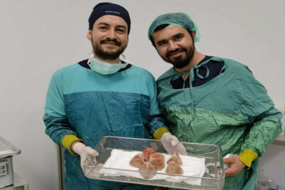 Mersin'de hastanın mesanesinden 2 kilo 200 gram taş çıktı