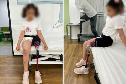 Depremzede çocuklara protez