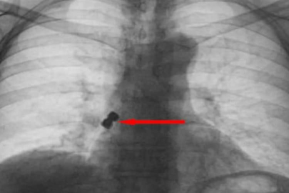 Diş tedavisinde hastanın başına gelmeyen kalmadı