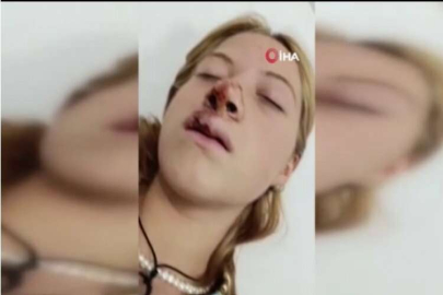 Sultangazi’de genç kızın yüzüne kaldırım taşı atıp, dişlerini kırdılar