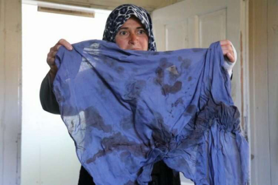 "Komşum beni darp etti" dedi, yaşadığı dehşeti anlattı