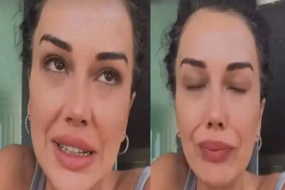 Dilan Polat'ın yakalandığı ''LUPUS HASTALIĞI'' nedir?