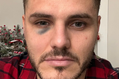 Dursun Özbek: "Dünkü penaltı pozisyonunda Djiku, özellikle Icardi'ye bir sağ kroşe vurdu. Bu hareketin cezalandırılması gerekirdi."