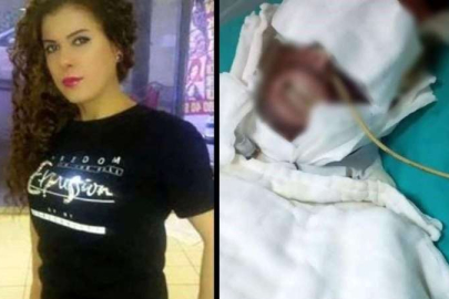 Avcılar’da eski sevgilisine kimyasal madde ile saldıran sanığın yargılanmasına devam edildi