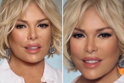 Ajda Pekkan'ın yüzüne yeni estetik müdahale: 77 yaşındaki şarkıcının son hali şaşırttı