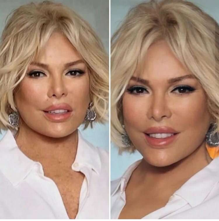 Ajda Pekkan'ın yüzüne yeni estetik müdahale 77 yaşındaki şarkıcının son hali şaşırttı 2