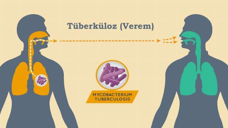  Mart Dünya Tüberküloz Günü