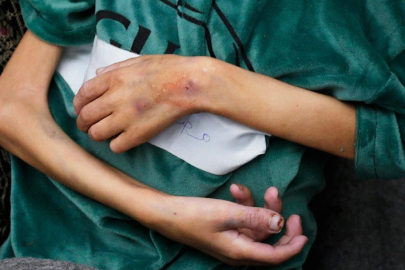 İsrail saldırıları altındaki Gazze'de bir haftada 4 çocuk daha "açlıktan" öldü