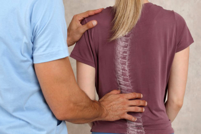 Skolyoz vakaları artıyor, uzmanlar uyarıyor