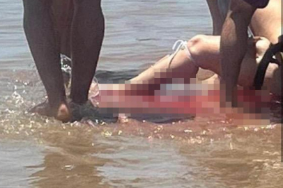 ABD’de halk plajında köpek balığı saldırısı