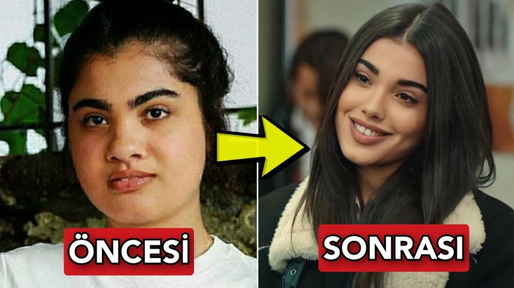 lizge cömert eski hali