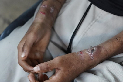 Filistinli esir, İsrail cezaevinde yaşadıklarını anlattı: Klozet suyu ile beni boğmaya çalıştılar