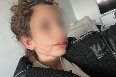 Konya'da üniversite öğrencisi genç kız sevgilisi tarafından darp edildi, şüpheli serbest bırakıldı