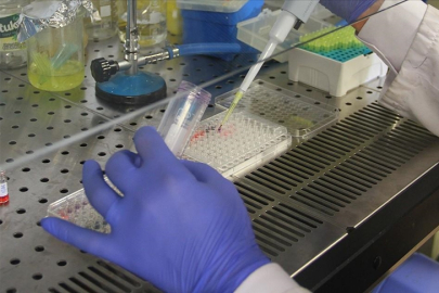 DSÖ Herpes virüsüne karşı uyardı! HSV-2 virüsü nedir ve nasıl bulaşır?