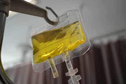 Sarı serumun ölümcül tehlikesi: Prof. Dr. Şevket Özkaya uyardı!