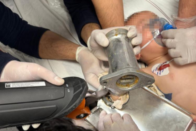 Hatay’da 2 yaşındaki çocuğun elini kıyma makinesine kaptırdı