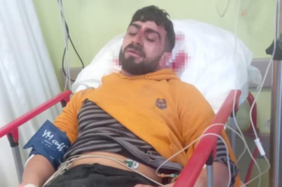 Edirne'de hurda toplayıcısının kafasına buldozer cismi isabet etti, hafızasını kaybetti