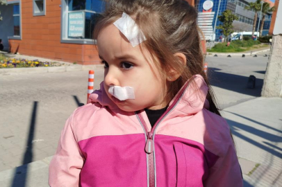 Sahipsiz köpekler 3 yaşındaki çocuğa saldırdı