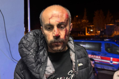 Şanlıurfa’da avukata darp iddiası