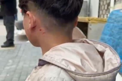 Bursa’da oyun oynayan çocuğa dükkan sahibinden şiddet