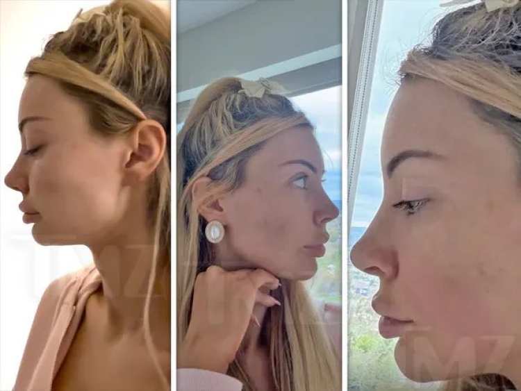 Andrew Tate’in eski sevgilisi Bri Stern Cinsel şiddet uyguladı, ölümle tehdit etti 2