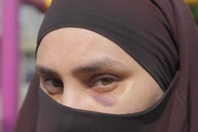 Mersin’de parkta dehşet: Anne ve çocuklarına vahşi saldırı kamerada!