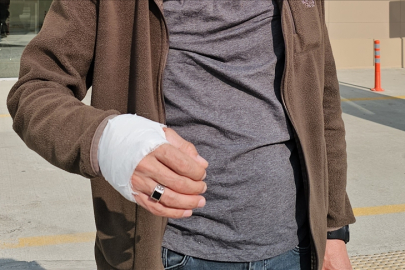 Kurban Bayramı'nın ilk gününde 14 bin 372 kişi yaralandı