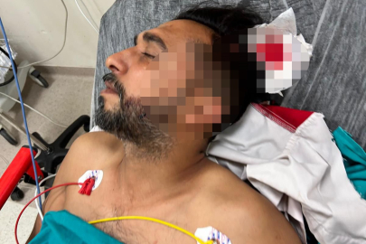 Adana'da korkutan olay! Sipariş hazırlarken başına yorgun mermi isabet etti