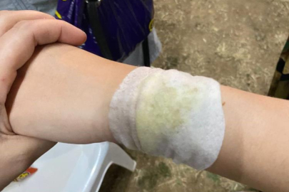 Bursa’da Hıdırellez şenliği kıvılcımları çocukları yaktı: 4 çocuk hafif yaralandı