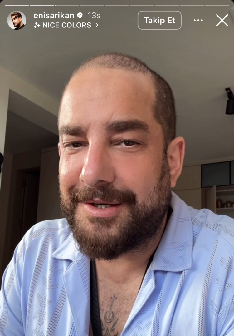 Enis Arıkan'ı tanıyamayacaksınız! Yıllardır imzası olan protez saçlara veda etti, son hali olay oldu! 2