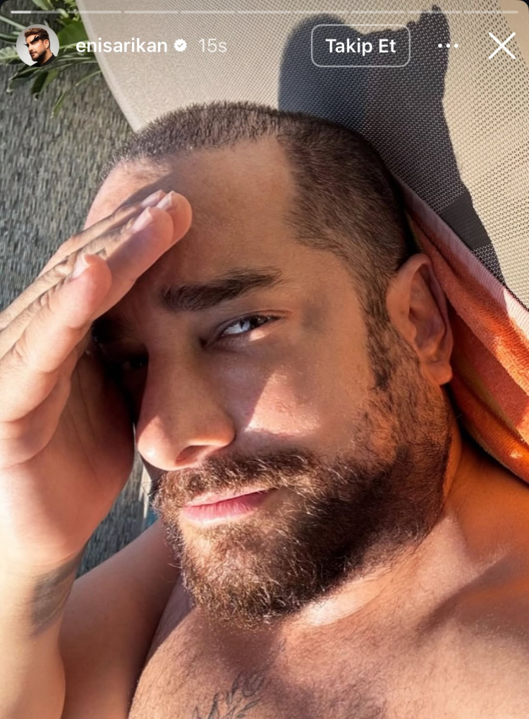 Enis Arıkan'ı tanıyamayacaksınız! Yıllardır imzası olan protez saçlara veda etti, son hali olay oldu! 3