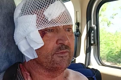 Aslanın saldırısına uğrayan çiftçi o anları anlattı: "Biraz güçlü olmasaydım, şu anda bende belki de yoktum"