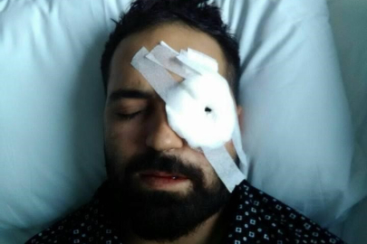 "Kelime-i Şehadet Getir" diyerek ateş ettiler: 15 Temmuz gazisi o anları anlattı