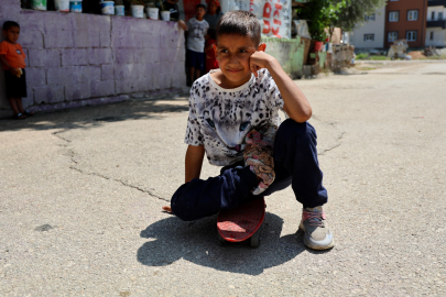 11 yaşındaki Serdal'ın dramı yürek burktu! Adana Valiliği devreye girdi