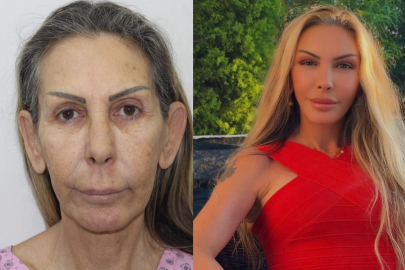 Petek Dinçöz'ün annesi yüz gençleştirme ameliyatı oldu: Son hali şaşırttı