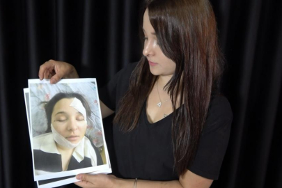 Eski sevgilisinin dehşetinden kurtulan genç kadın yaşadığı kabusu anlattı