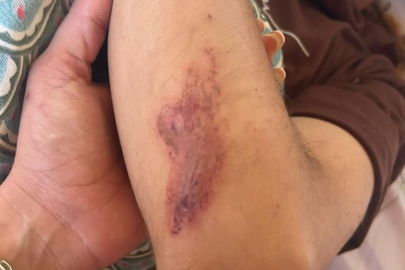 Pozantı’da sokak köpeklerini besleyen veteriner ve ailesine komşu şiddeti!