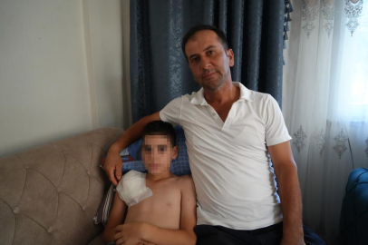 Samsun’da dehşet: Köpek saldırısı 11 yaşındaki çocuğun kolu felç bıraktı