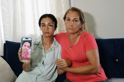 Adana’da dehşet: Eski eşini öldüresiye dövdü, “merdivenden düştü” dedi