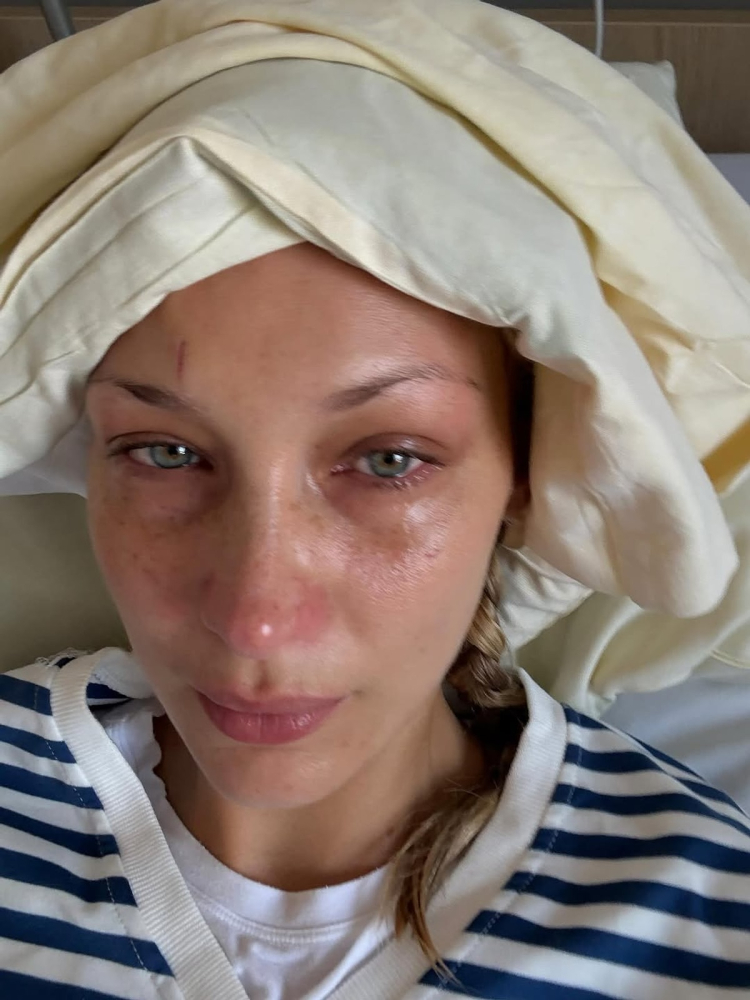 Bella Hadid Lyme hastalığıyla mücadelesini paylaştı! Hayranlarını hüzne boğdu 2