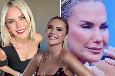 Ekranlarda filtresiz görüntüsü olay olan Ece Erken kaç yaşında? Estetiği var mı?