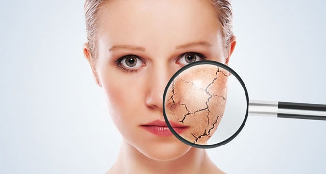 1. Nemlendirici Kullanımı Şart