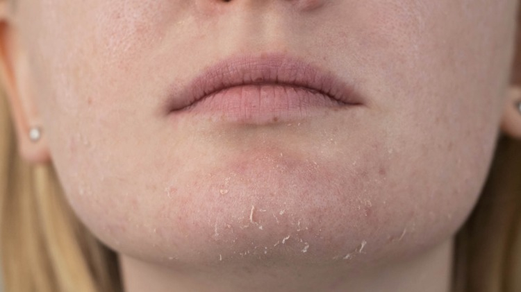 3. Doğru Duş Alışkanlıkları