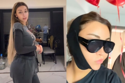 Mika Raun 'dan yeni estetik operasyon: Takipçileriyle paylaştı!