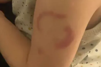 Edirne’de öğretmen, öğrencisini ısırdığı iddiasıyla tutuklandı