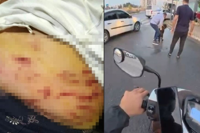 Sokakta ağızlıksız gezdirilen Rottweiler dehşet saçtı: Önce kadına, sonra kuryeye saldırdı