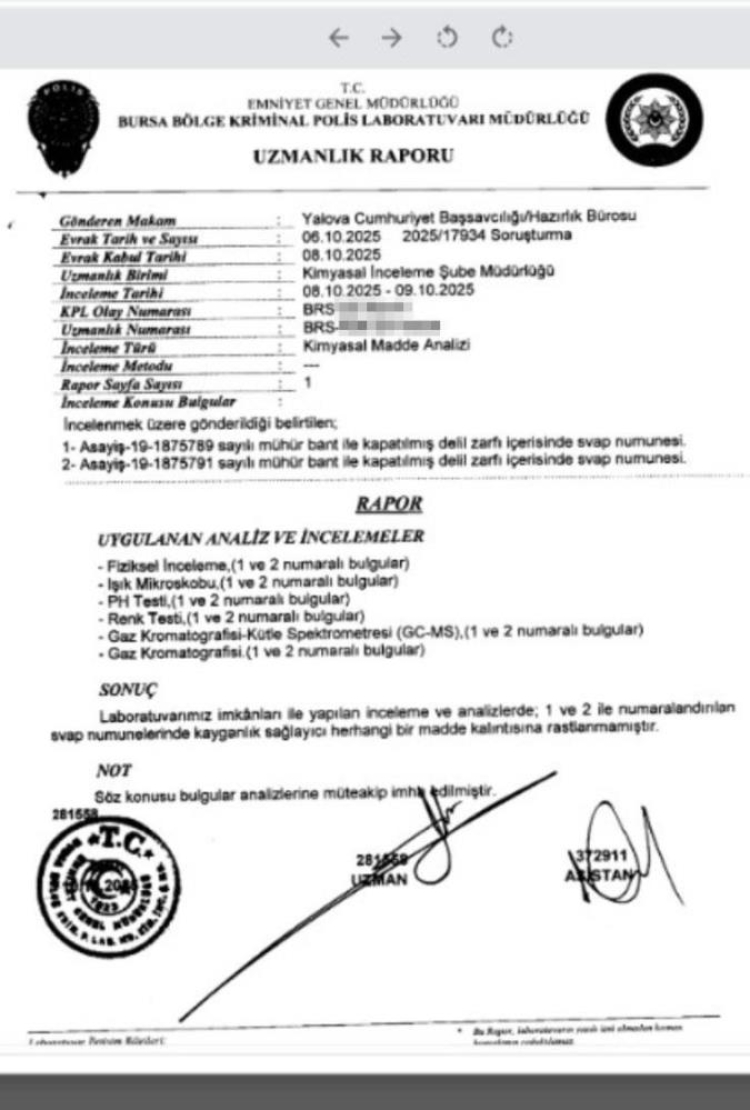 Sanatçı Güllü’nün ölümünde kriminal rapor ortaya çıktı Zeminde kayganlaştırıcı maddeye rastlanmadı 2