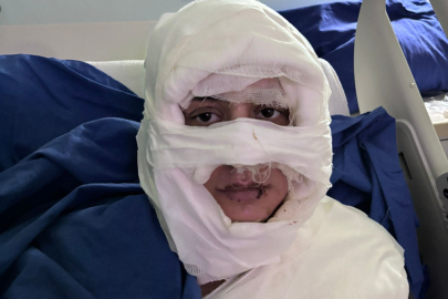 Kadıköy’de eğlence mekanında korku dolu anlar: Kadın üzerine benzin dökülüp ateşe verildi